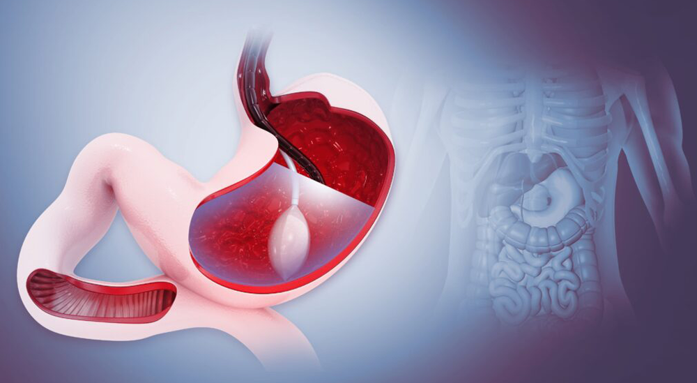 Metabolic Surgery vs Bariatric Surgery: Understanding the Key Differences